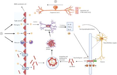 A review of the roles of pathogens in Alzheimer’s disease